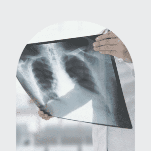 X-ray